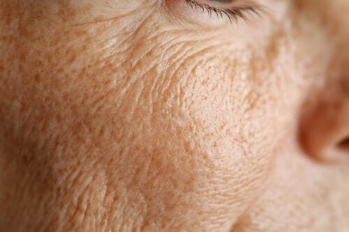 Close-up of mature skin texture, highlighting natural aging, only available at Potency No. 710 for skincare solutions.